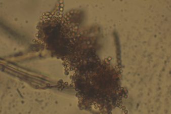 Aspergillus