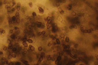 Aureobasidium
